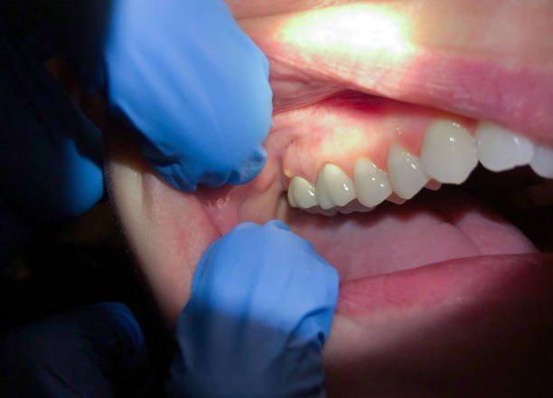 Best Walk-In Emergency Dentist in Mckinney, TX